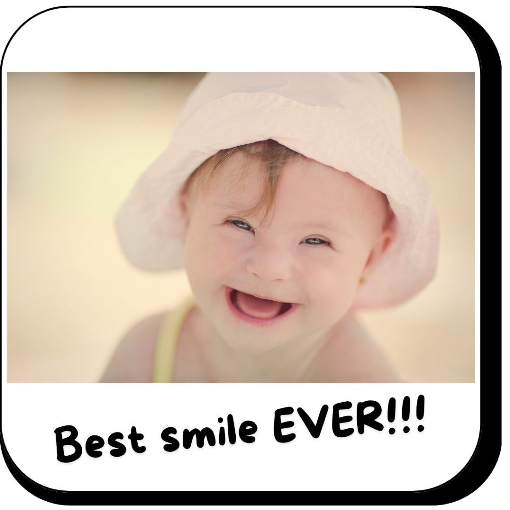 people with Down Syndrome have the best smile